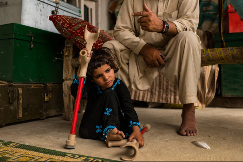 7 Afgan çocuk patlama sonrası tekrar yürümeyi öğreniyor 10