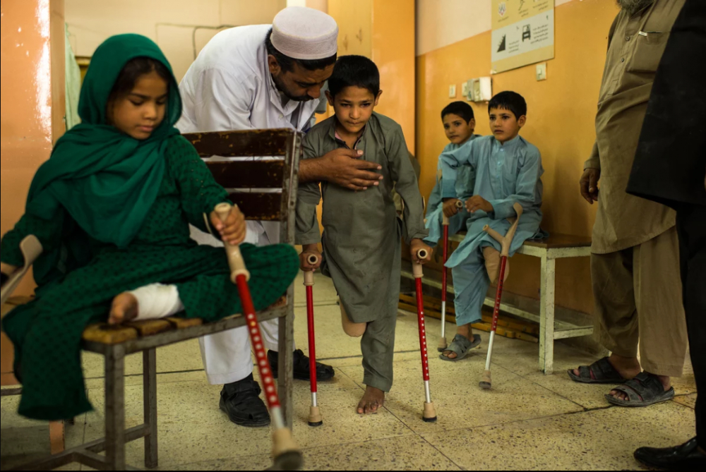 7 Afgan çocuk patlama sonrası tekrar yürümeyi öğreniyor 14