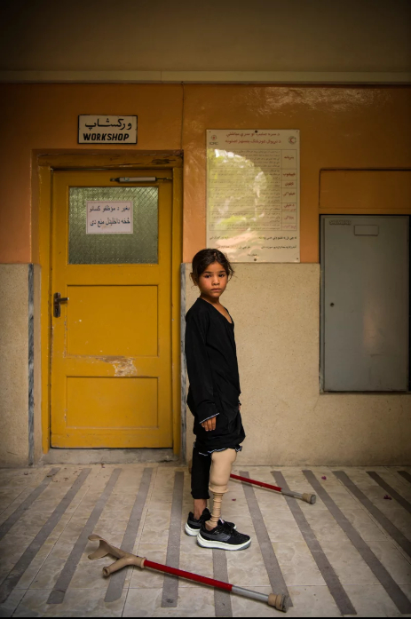 7 Afgan çocuk patlama sonrası tekrar yürümeyi öğreniyor 17