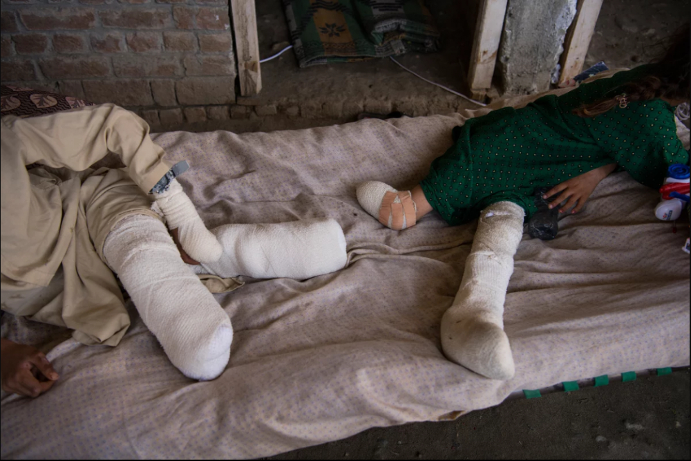 7 Afgan çocuk patlama sonrası tekrar yürümeyi öğreniyor 7