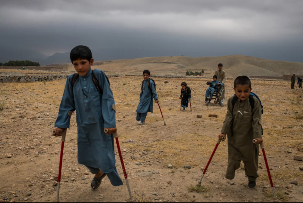 7 Afgan çocuk patlama sonrası tekrar yürümeyi öğreniyor 8
