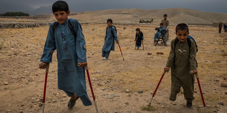7 Afgan çocuk patlama sonrası tekrar yürümeyi öğreniyor