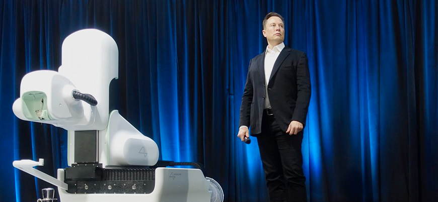 Elon Musk insan beynine çip takmak için ABD'den onay aldı