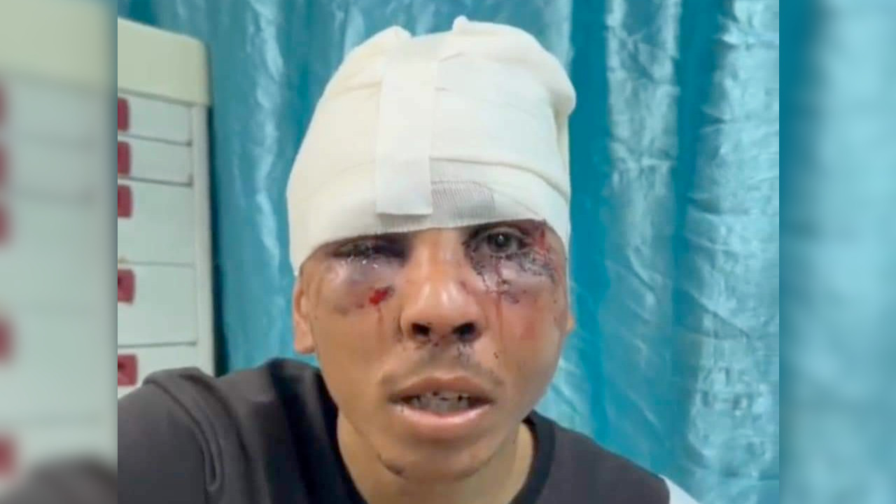 Dövüldü ve canlı kalkan olarak kullanıldı: Gazzeli genç İsrail vahşetini anlatıyor