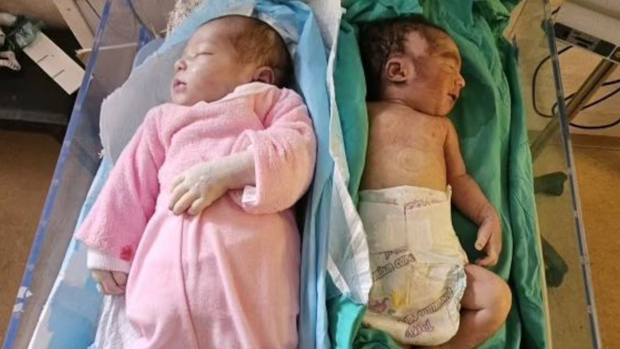Gazze'de açlıktan ölen bebek sayısı 15'e yükseldi