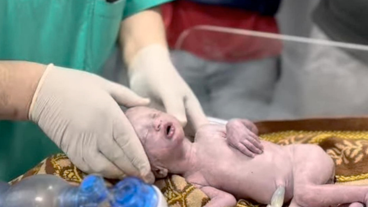 Gazze'de İsrail saldırısında ölen annenin karnındaki bebek kurtarıldı