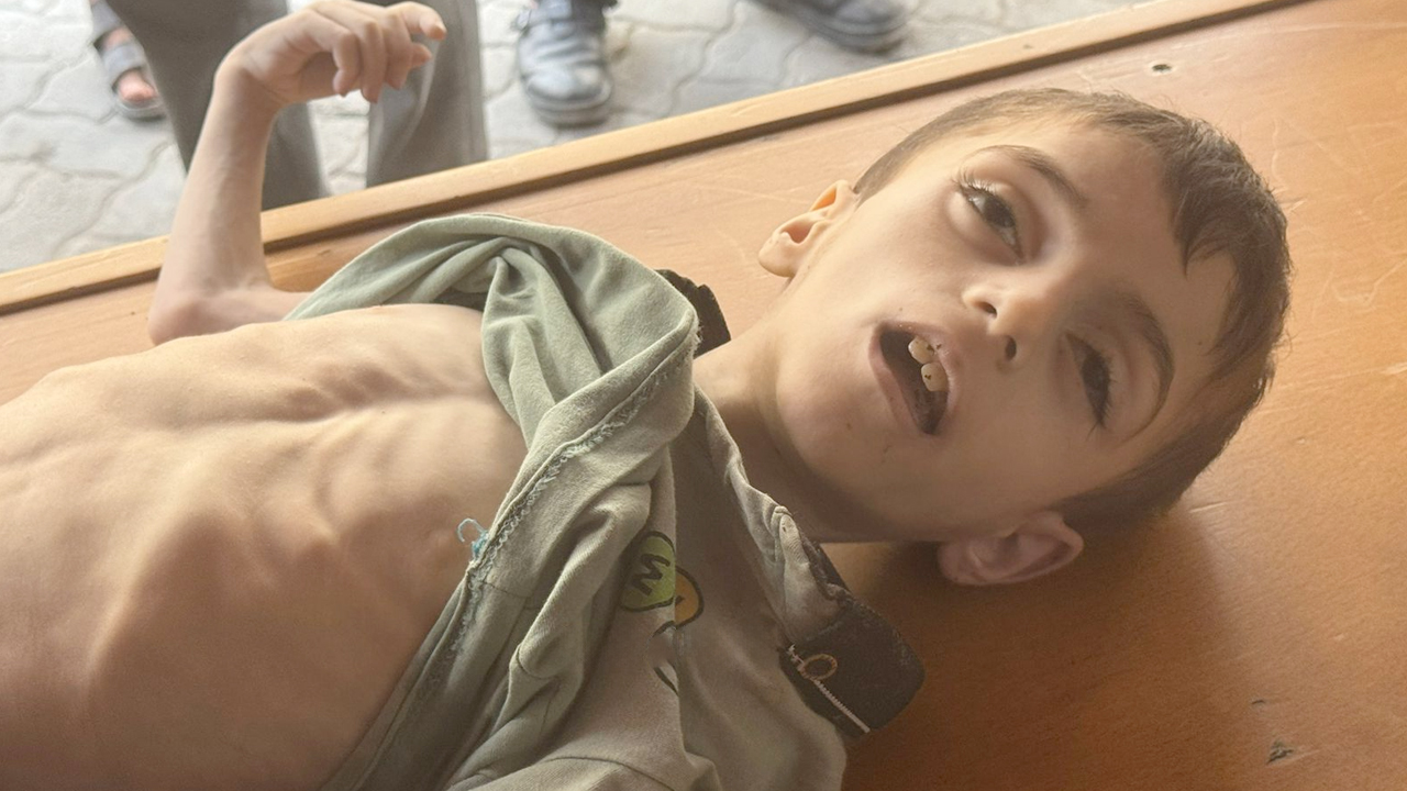 Gazze'de bir çocuk daha açlıktan öldü