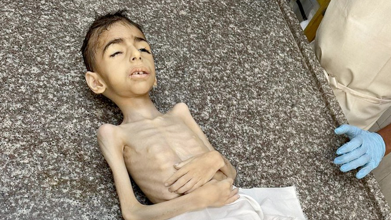 İsrail ablukası Gazze'de bir çocuğu daha açlıktan öldürdü
