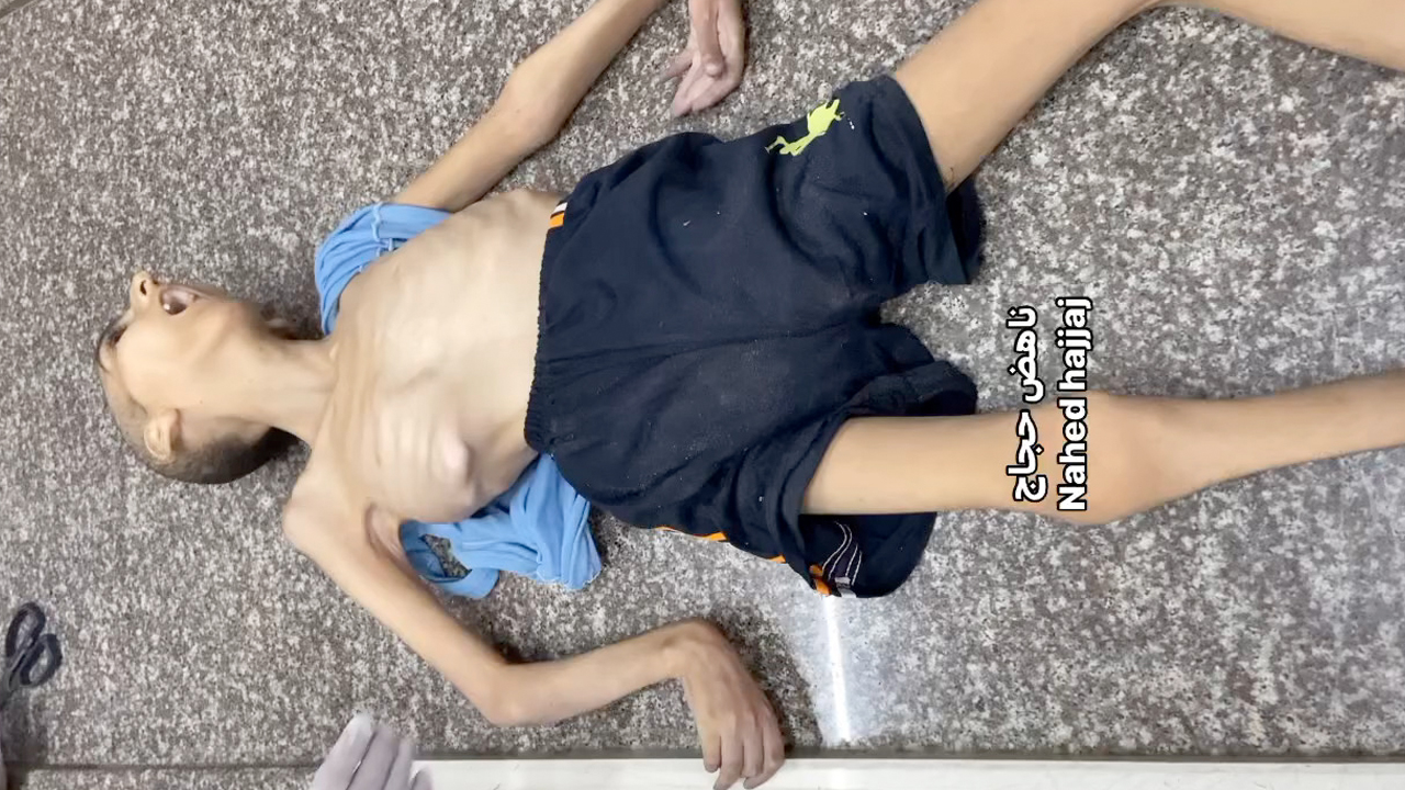 Gazze'de 12 yaşındaki bir çocuk açlıktan öldü