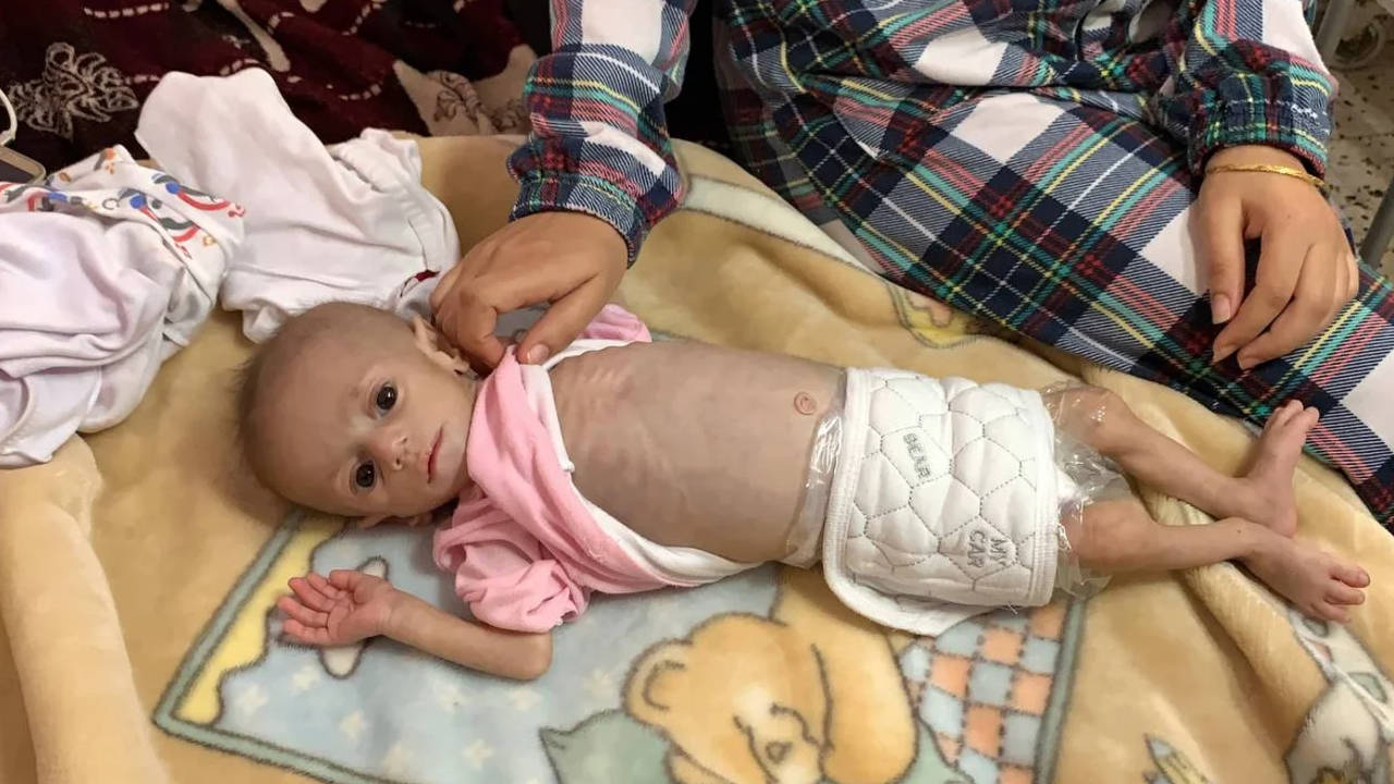 Gazzeli bebekler derinleşen İsrail ablukası altında açlıkla savaşıyor