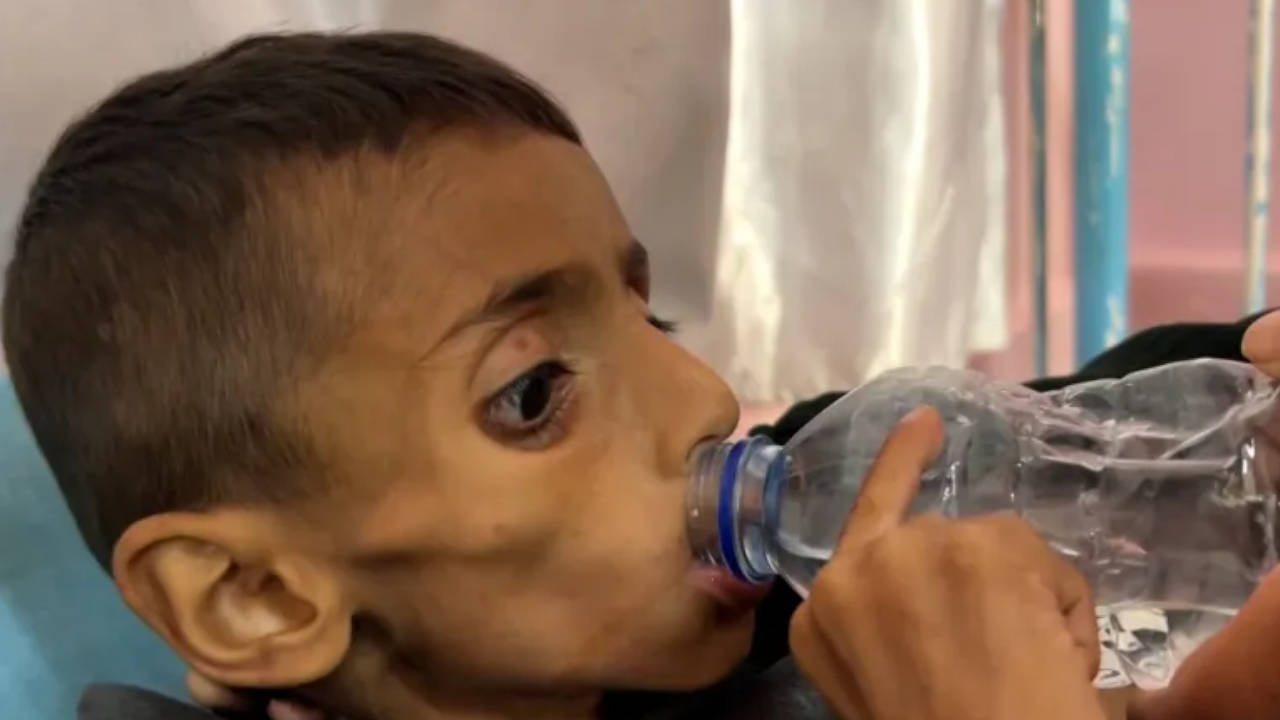 Gazzeli anne: Çocuklarımız bir deri bir kemik kaldı