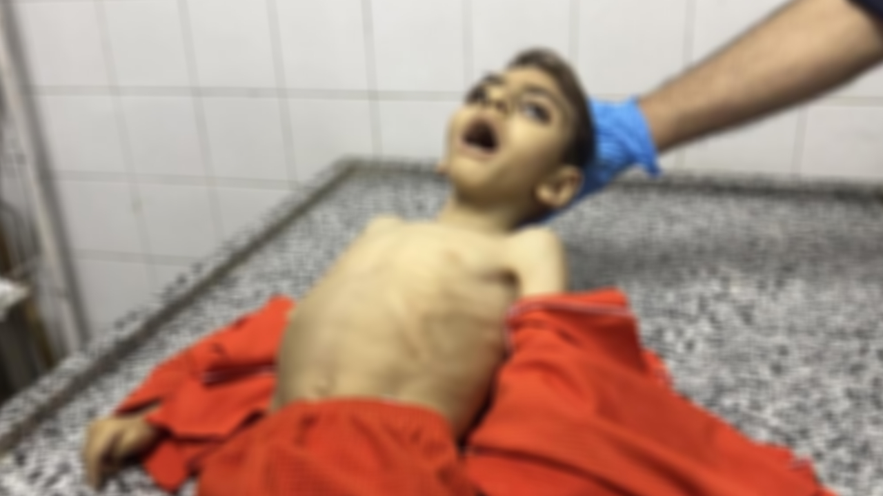 İsrail ablukası altındaki Gazze'de bir çocuk daha açlıktan öldü