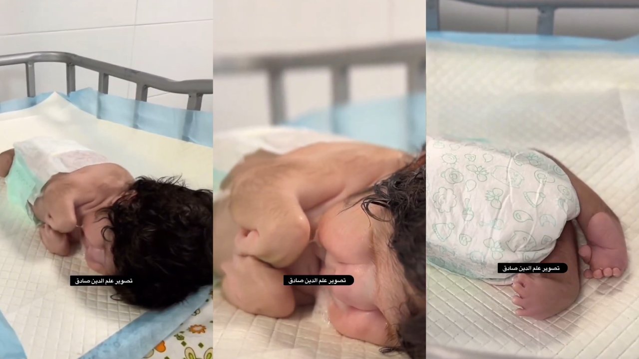 İsrail'in saldırıları sebebiyle Gazze'de sakat doğumlar artıyor