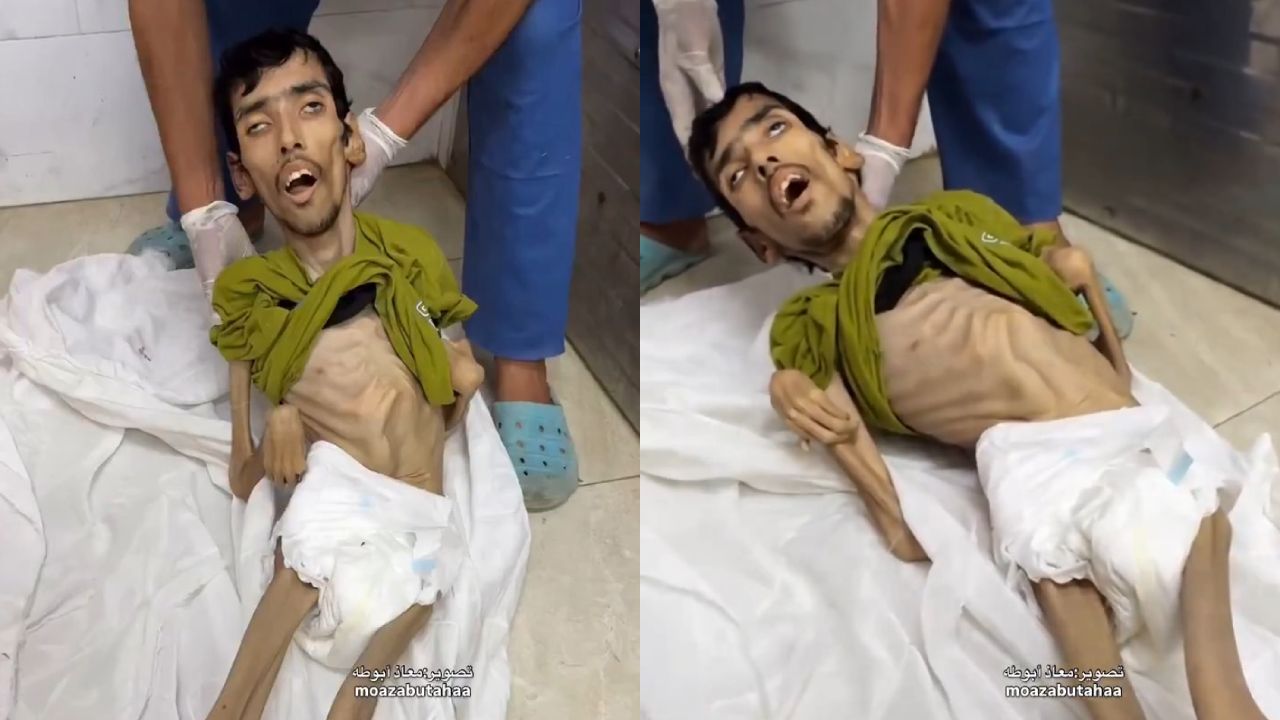 Gazze'de 29 yaşındaki bir genç açlıktan öldü