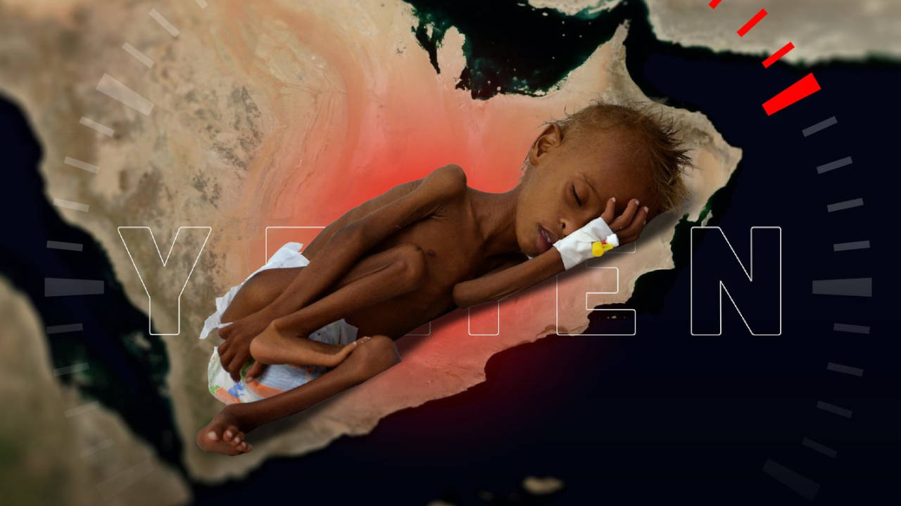 Yemen'de 17 milyon insan açlık çekiyor