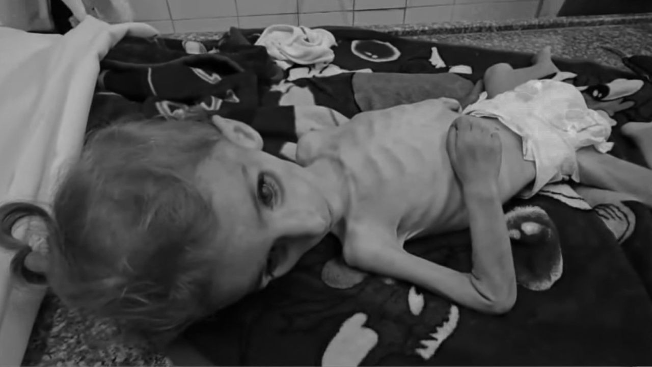 Gazze açlıktan ölüyor