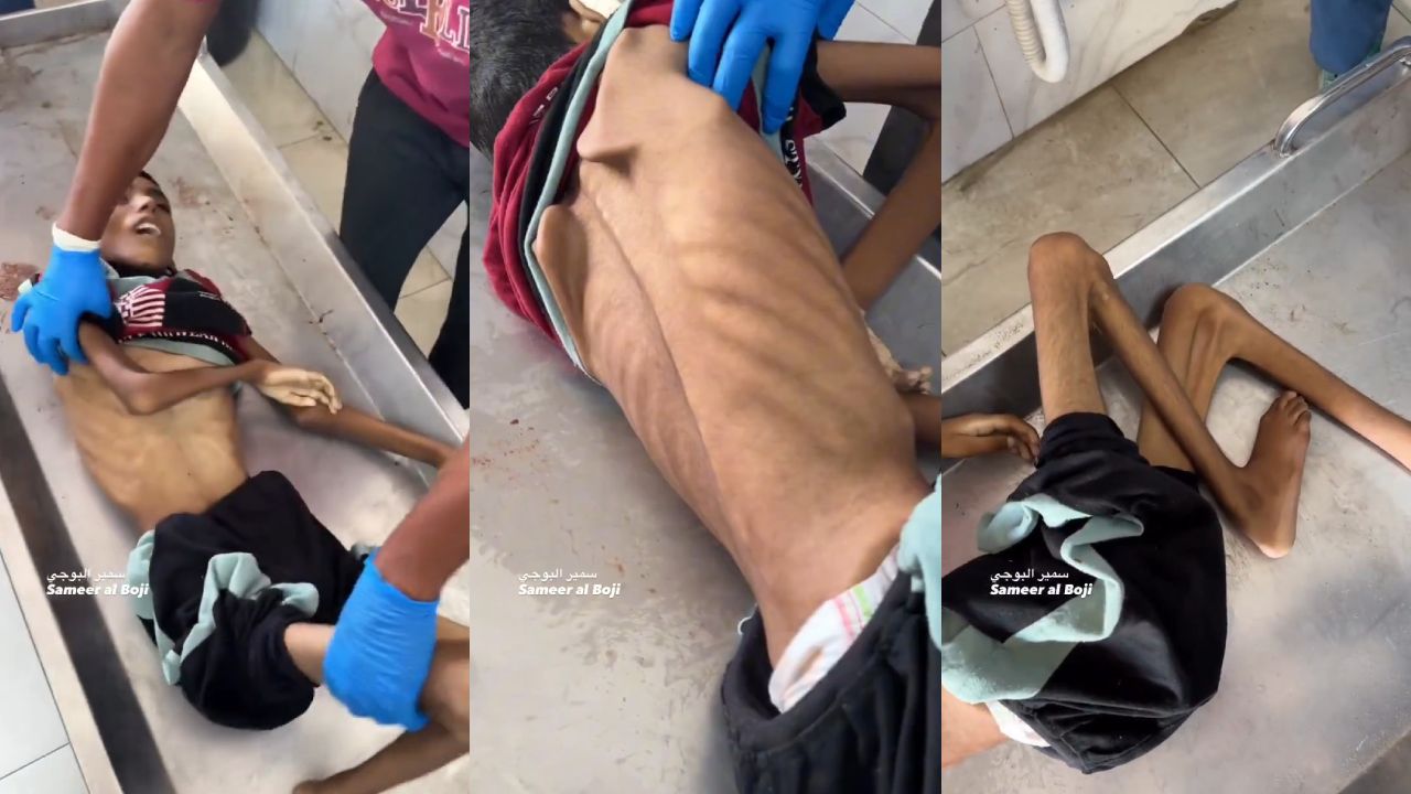 İsrail Gazze'de 12 yaşında bir çocuğu açlıktan öldürdü