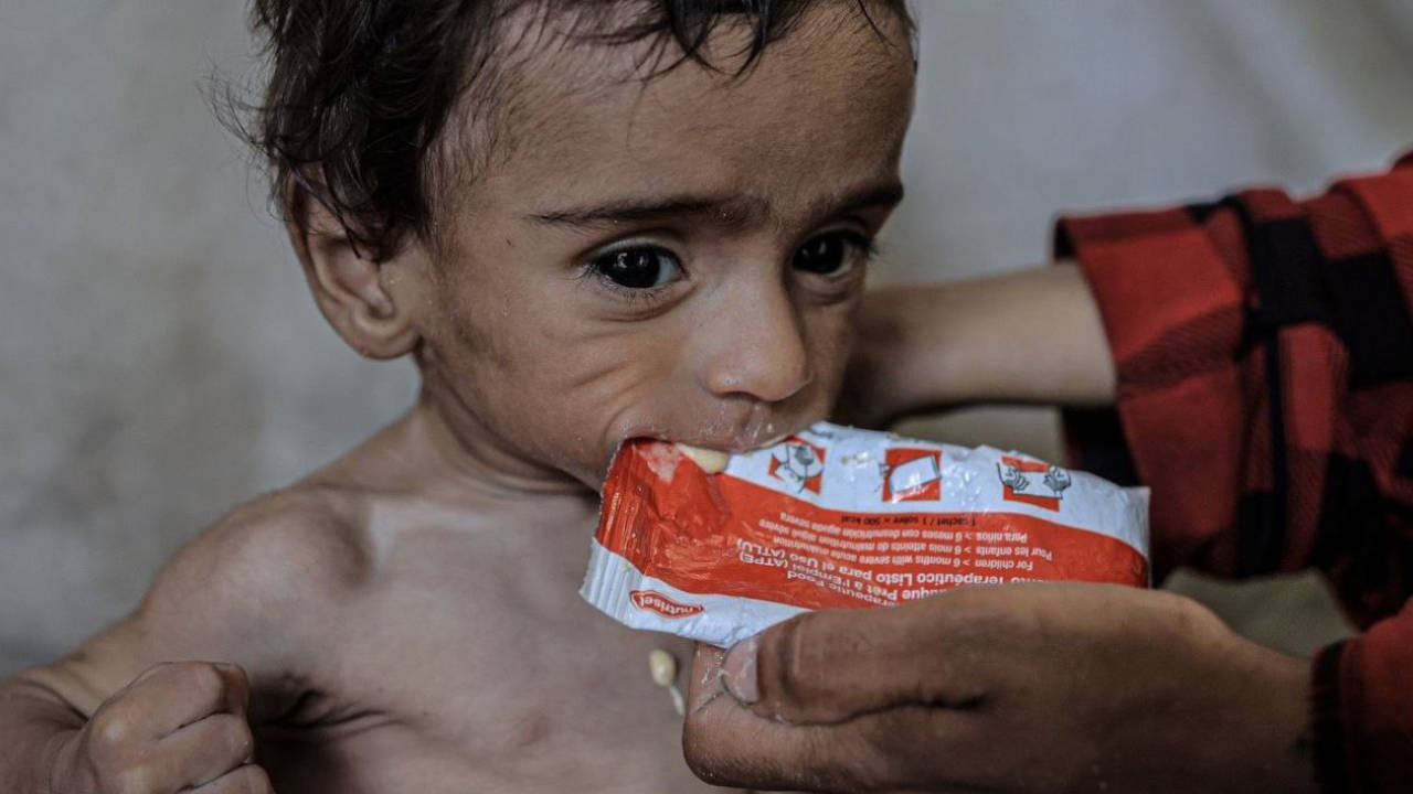 İsrail ablukası Gazze'de kitlesel açlığa yol açtı