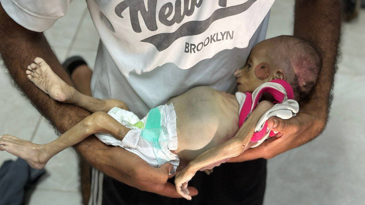 Gazze'de 100 binden fazla çocuk İsrail ablukası nedeniyle ölüm riski altında