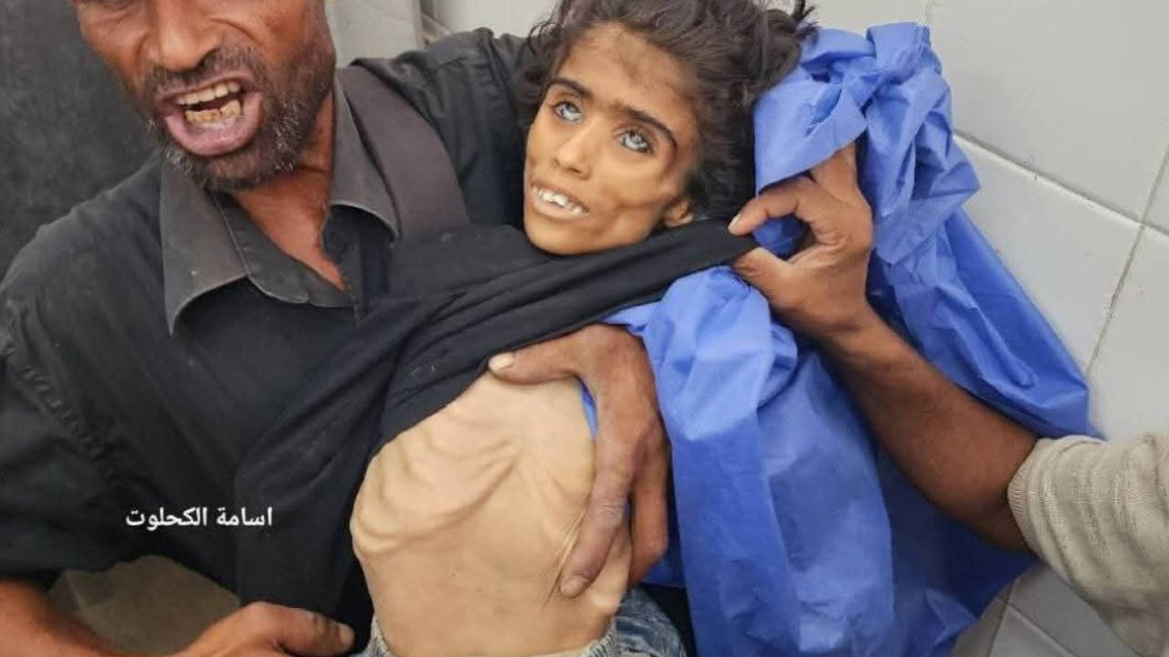 Gazze'de açlıktan ölenlerin sayısı 147'ye yükseldi