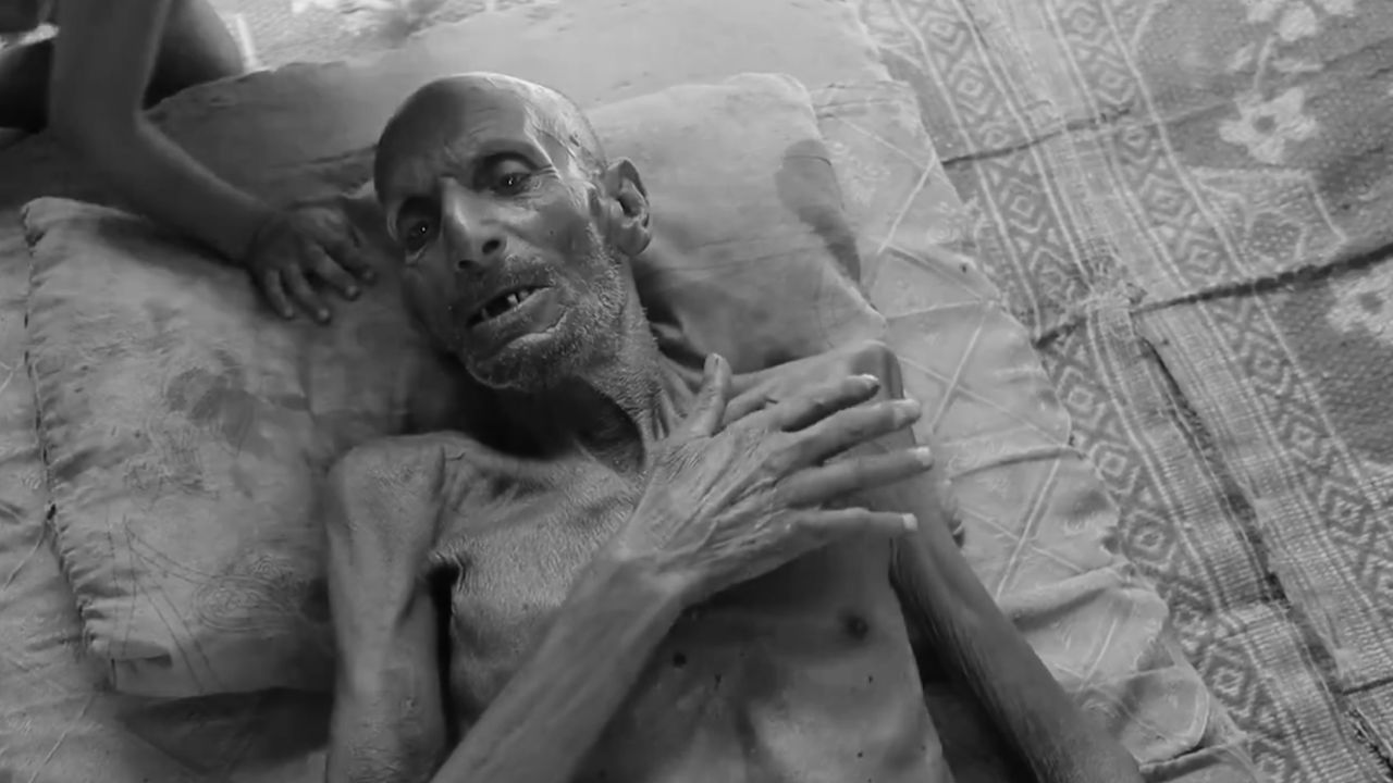 Gazze'de açlıktan ölenlerin sayısı 94'ü çocuk 188'e yükseldi