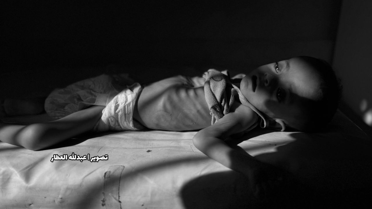 Gazze'de açlıktan ölenlerin sayısı 103'ü çocuk 227'ye yükseldi