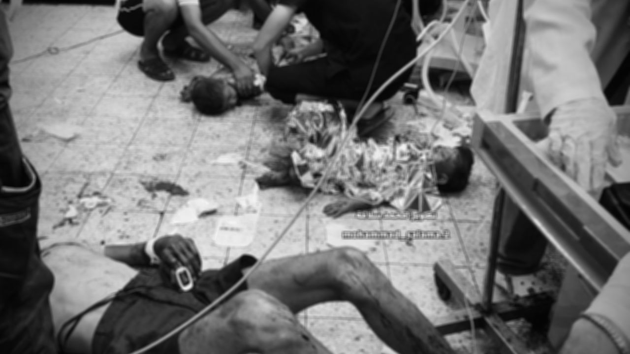 Gazze'de can kaybı 61 bin 776'ya yükseldi