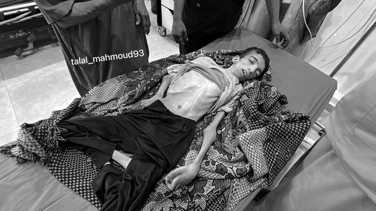 Gazze'de son 24 saatte 11 kişi açlıktan öldü