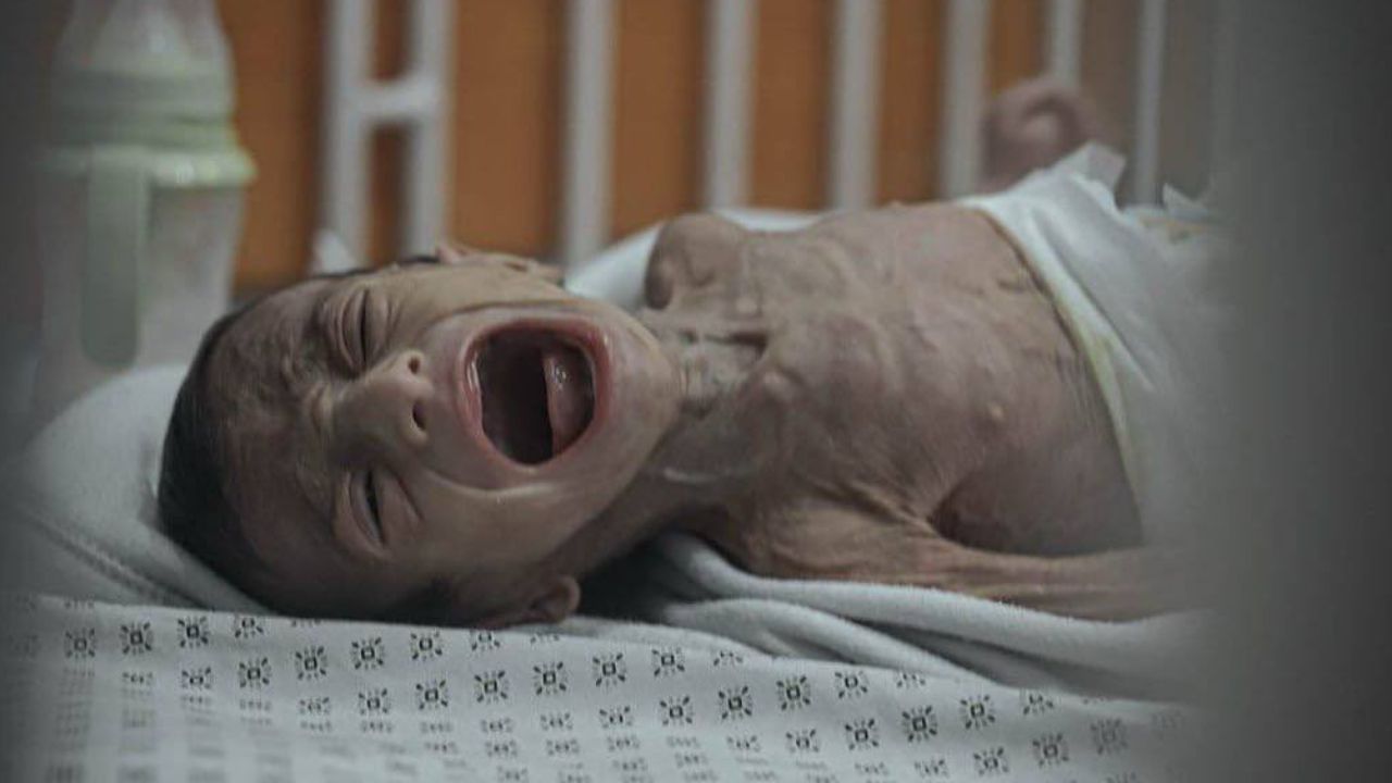 Gazze'de 24 saatte 3'ü çocuk 10 kişi açlıktan öldü