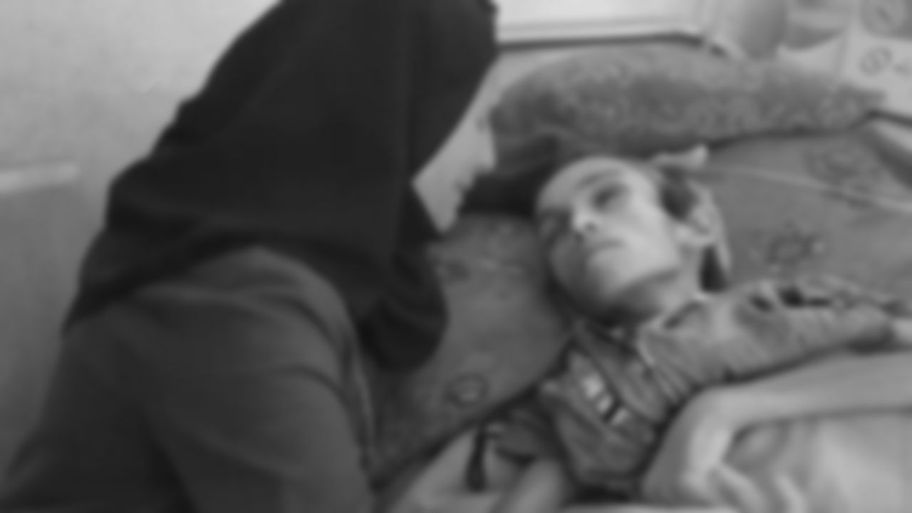 Gazze'de açlıktan ölenlerin sayısı 271'e yükseldi