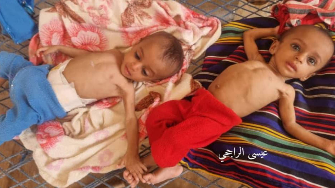 Yemen'de Husilerin kontrolündeki bölgede kıtlık baş gösteriyor