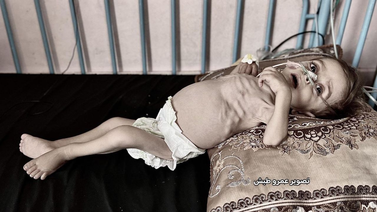 Gazze'de açlıktan ölenlerin sayısı 114'ü çocuk 281'e yükseldi