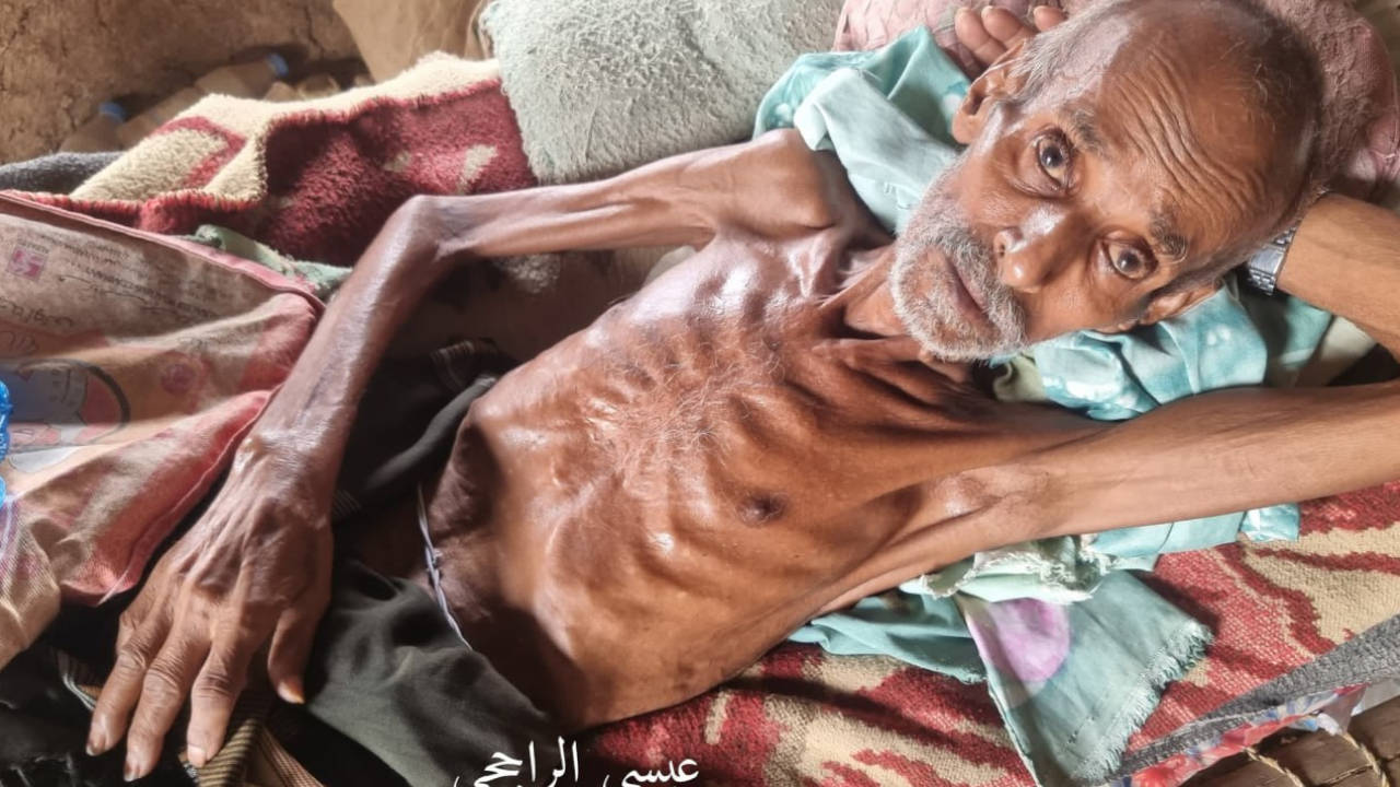 Yemen'de açlık krizi 18 milyon kişiyi tehdit ediyor