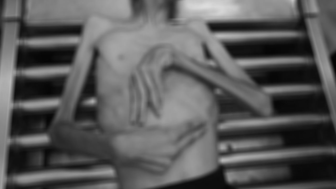 Gazze'de açlıktan ölenlerin sayısı 303'e yükseldi