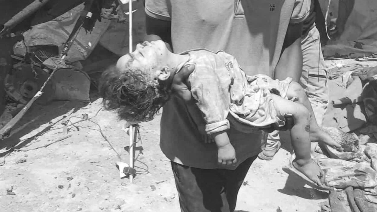 Siyonist vahşet Gazze'de 63 bin 371 can aldı