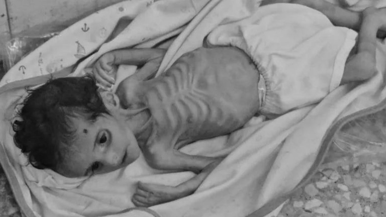 Gazze'de açlıktan can verenlerin sayısı 131'i çocuk 367'ye yükseldi