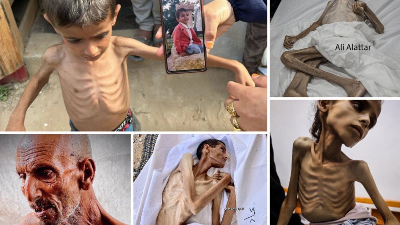 Gazze'de açlıktan ölenlerin sayısı 370'e yükseldi