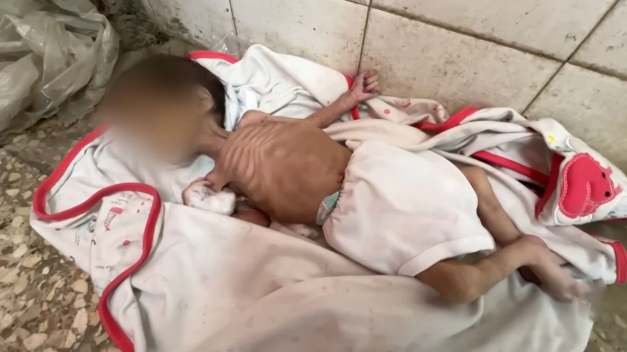 Gazze'de açlıktan ölenlerin sayısı 135'i çocuk 382'ye yükseldi