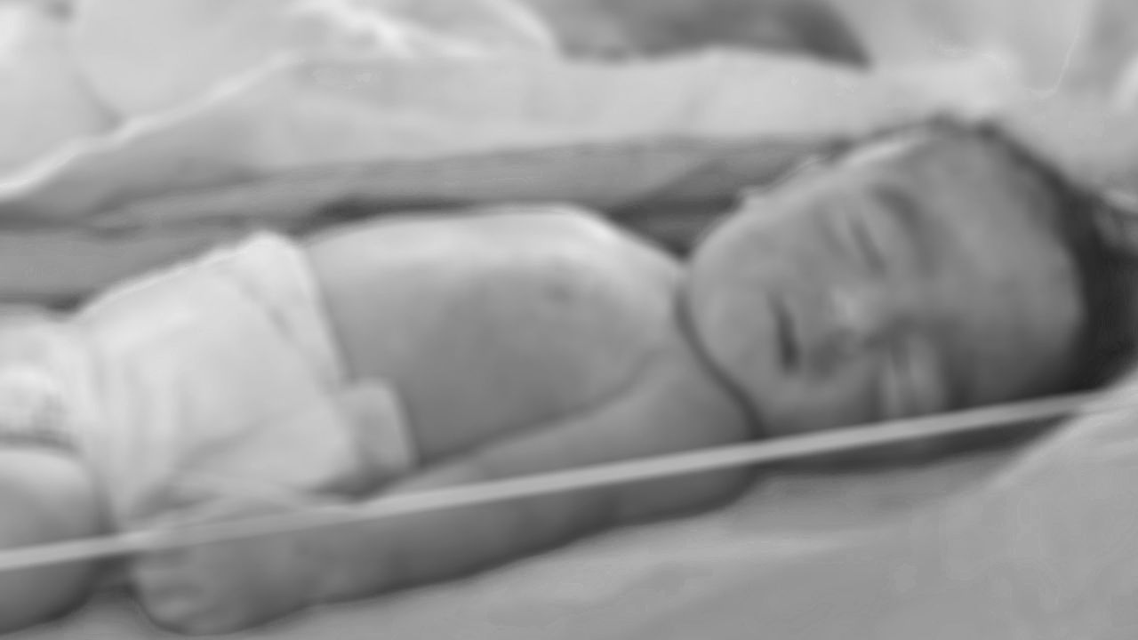 Gazze'de açlıktan ölenlerin sayısı 141'i çocuk 404'e yükseldi