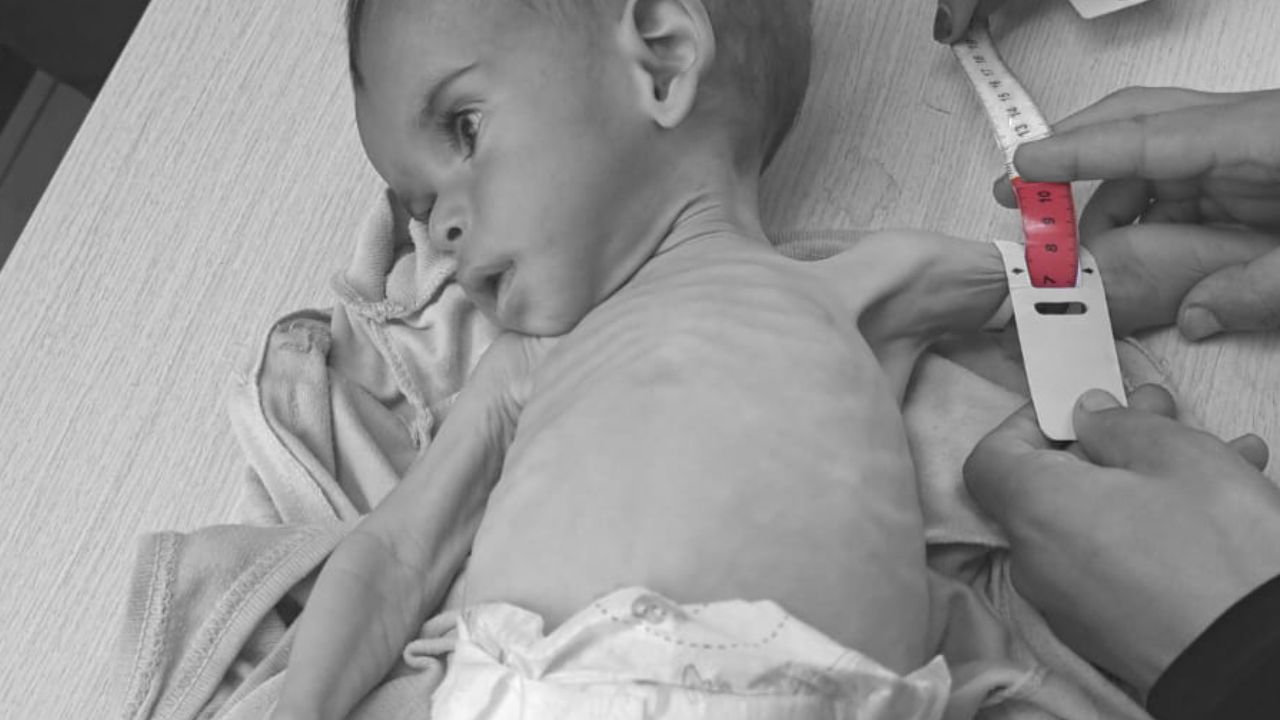 Gazze'de açlıktan ölenlerin sayısı 145'i çocuk 420'ye yükseldi