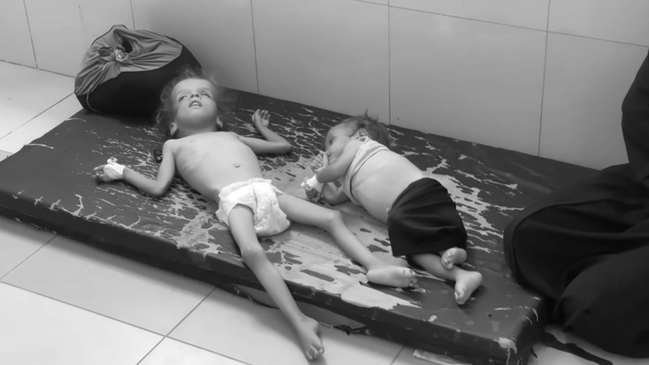 Gazze'de açlıktan ölenlerin sayısı 425'e yükseldi