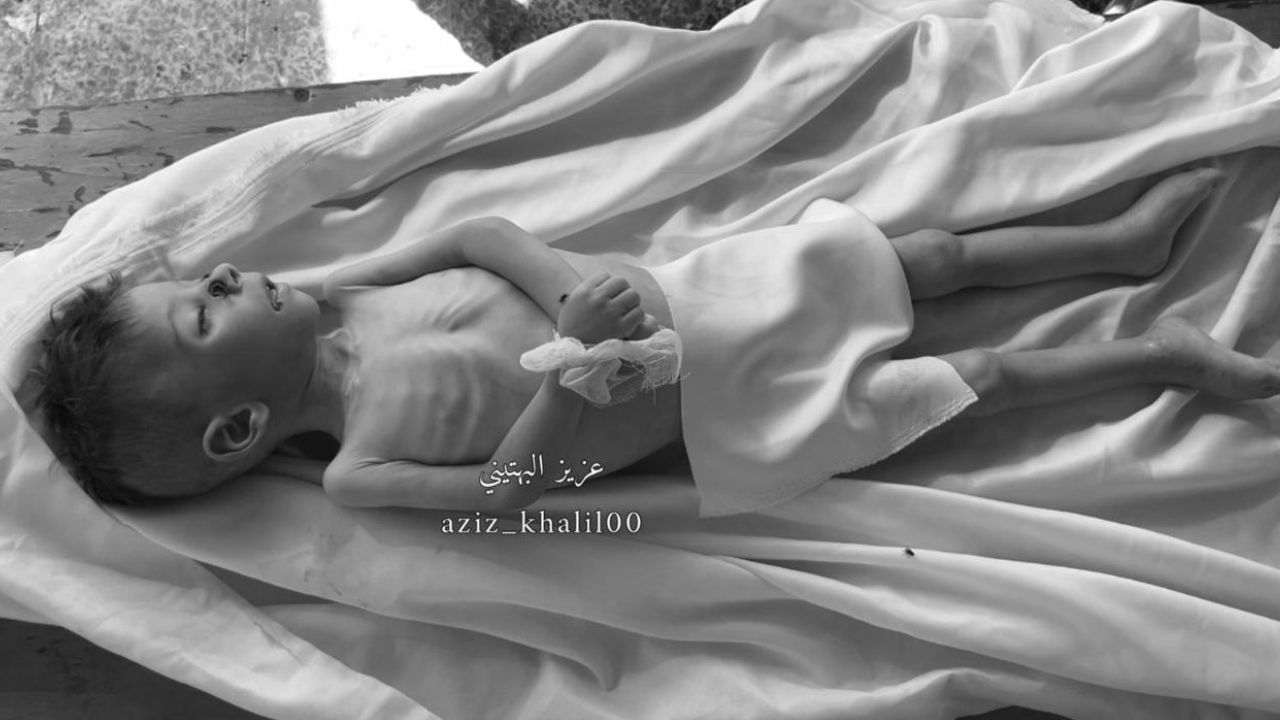 Gazze'de açlıktan ölenlerin sayısı 442'ye yükseldi