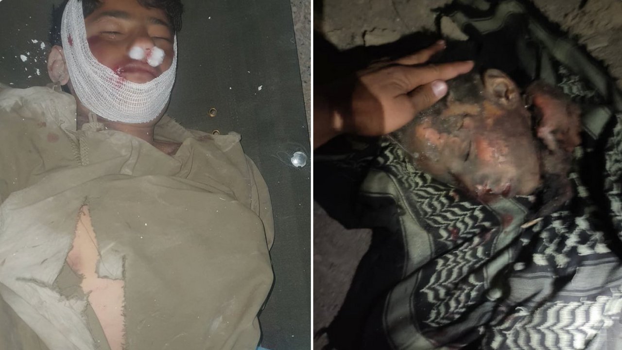 Pakistan ordusu ateşkesi ihlal etti, Afganistan'da sivilleri bombaladı