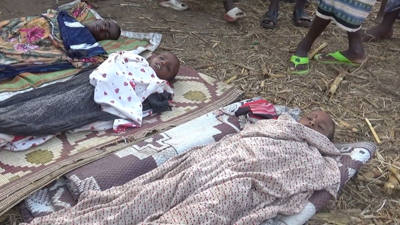 Somali'de ABD destekli güçlerin katlettiği çocukların görüntüleri ortaya çıktı