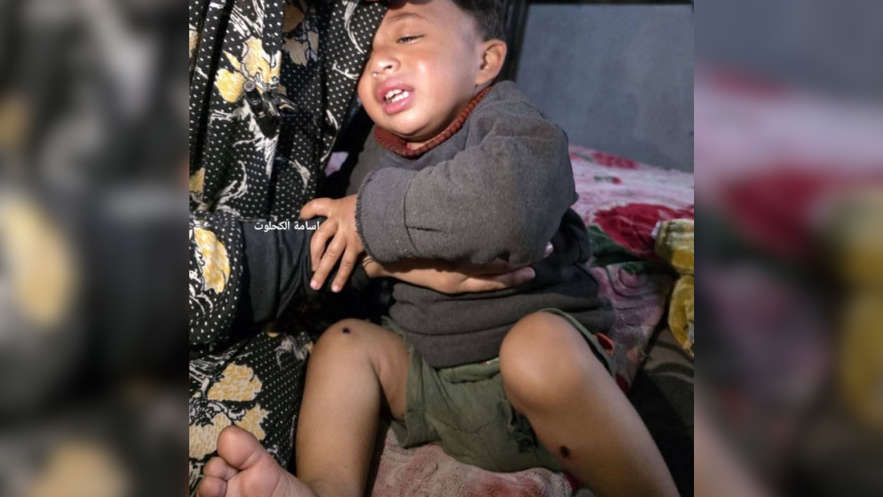 İsrail askerleri, Gazzeli bir babanın gözleri önünde çocuğunun üzerinde sigara söndürdü