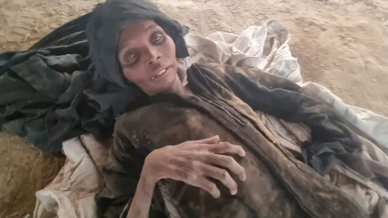 Unutulan Yemen'de insanlar açlıktan ölüyor