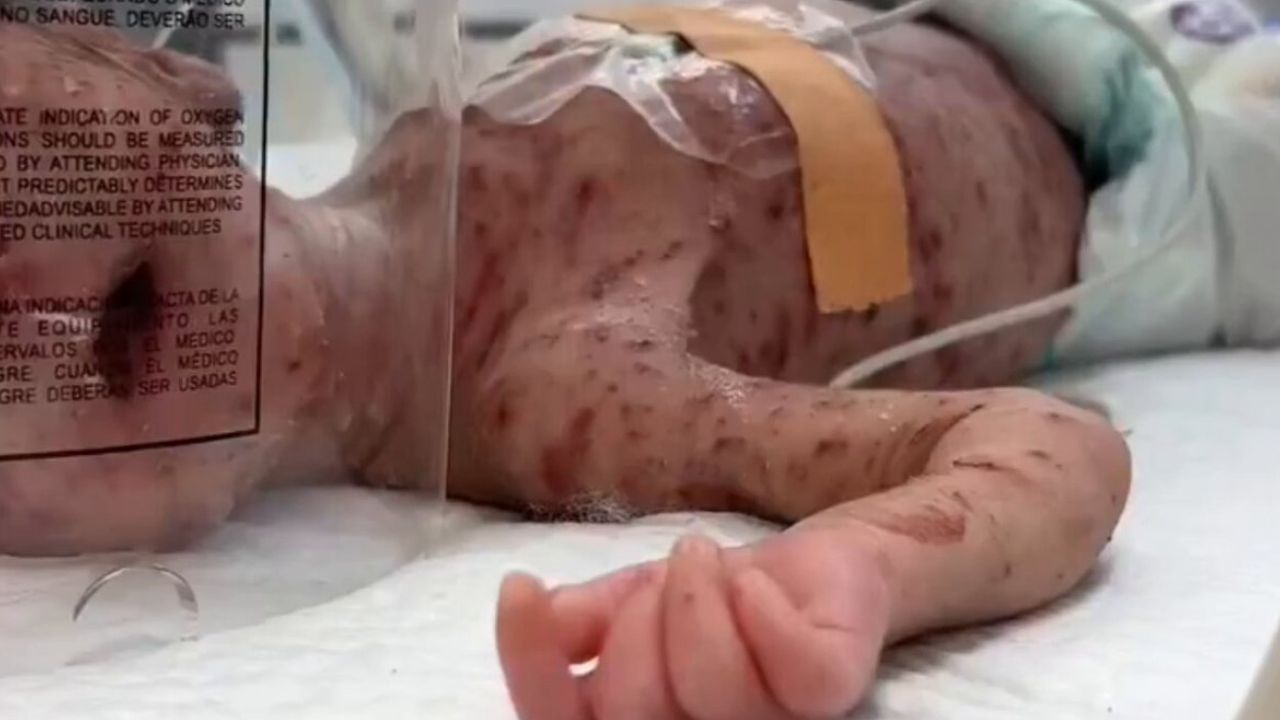 Gazze'de su çiçeği salgını günden güne yayılıyor