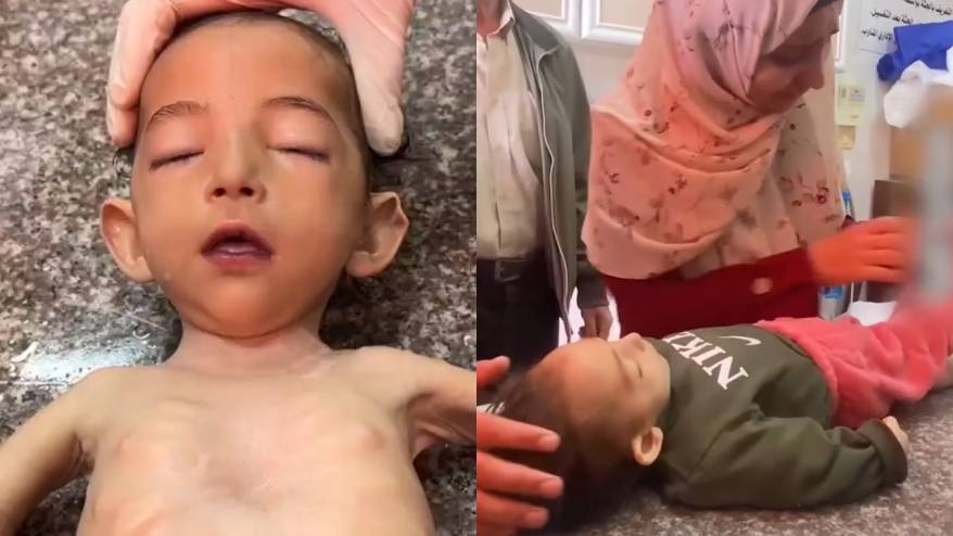 Gazze'de 11 aylık bebek açlıktan öldü