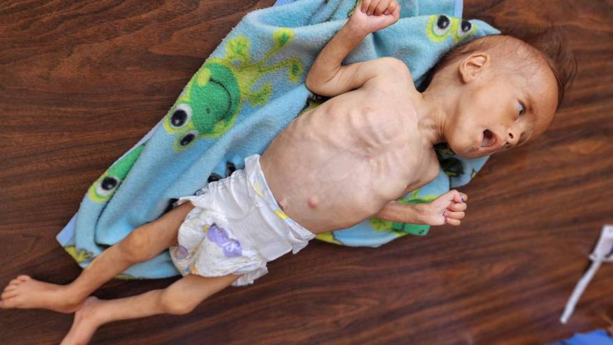 100'den fazla STK Gazze'de “toplu kıtlık” uyarısı yaptı