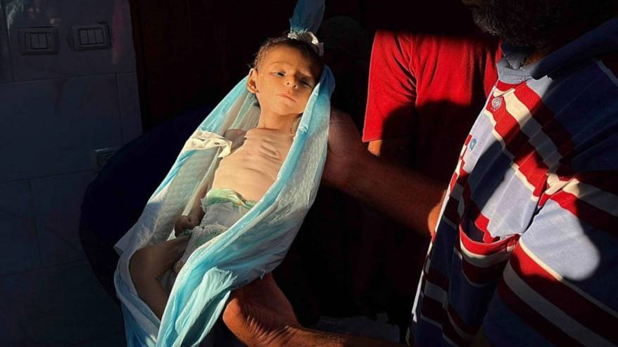 Gazze Şifa Hastanesi Müdürü: Çaresizlik safhasına girdik, insanlar açlıktan ölüyor